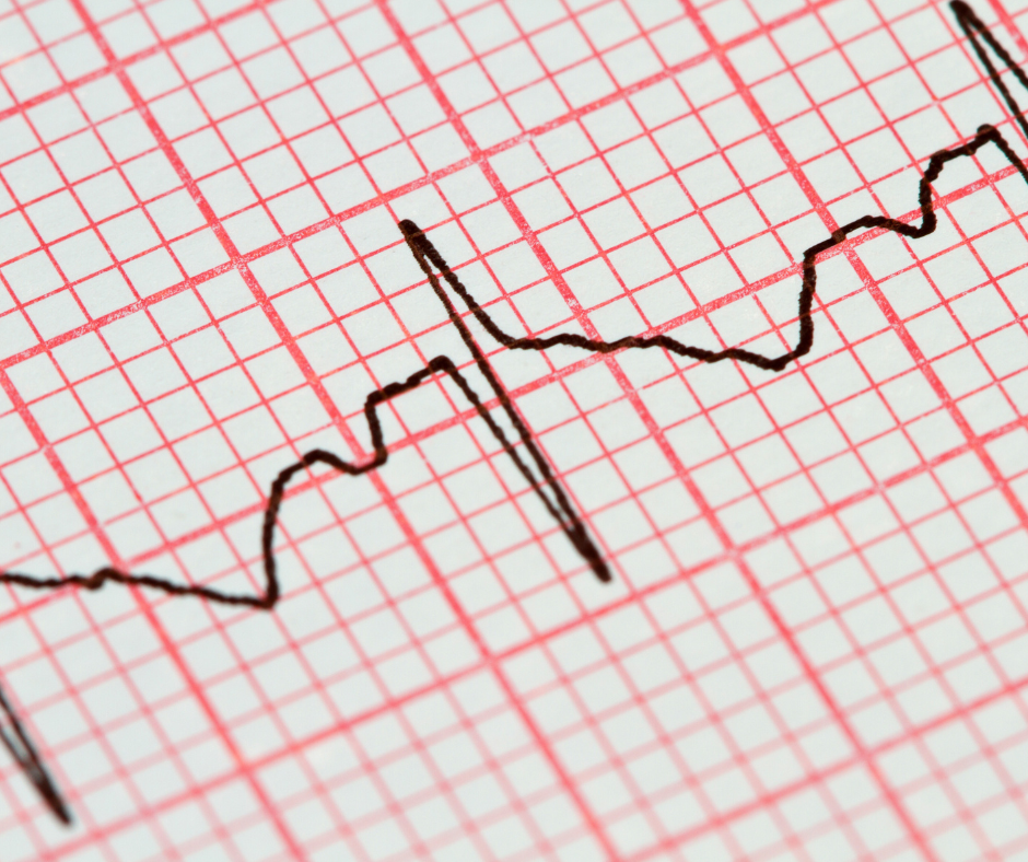 Clínica en Liberia para electrocardiograma